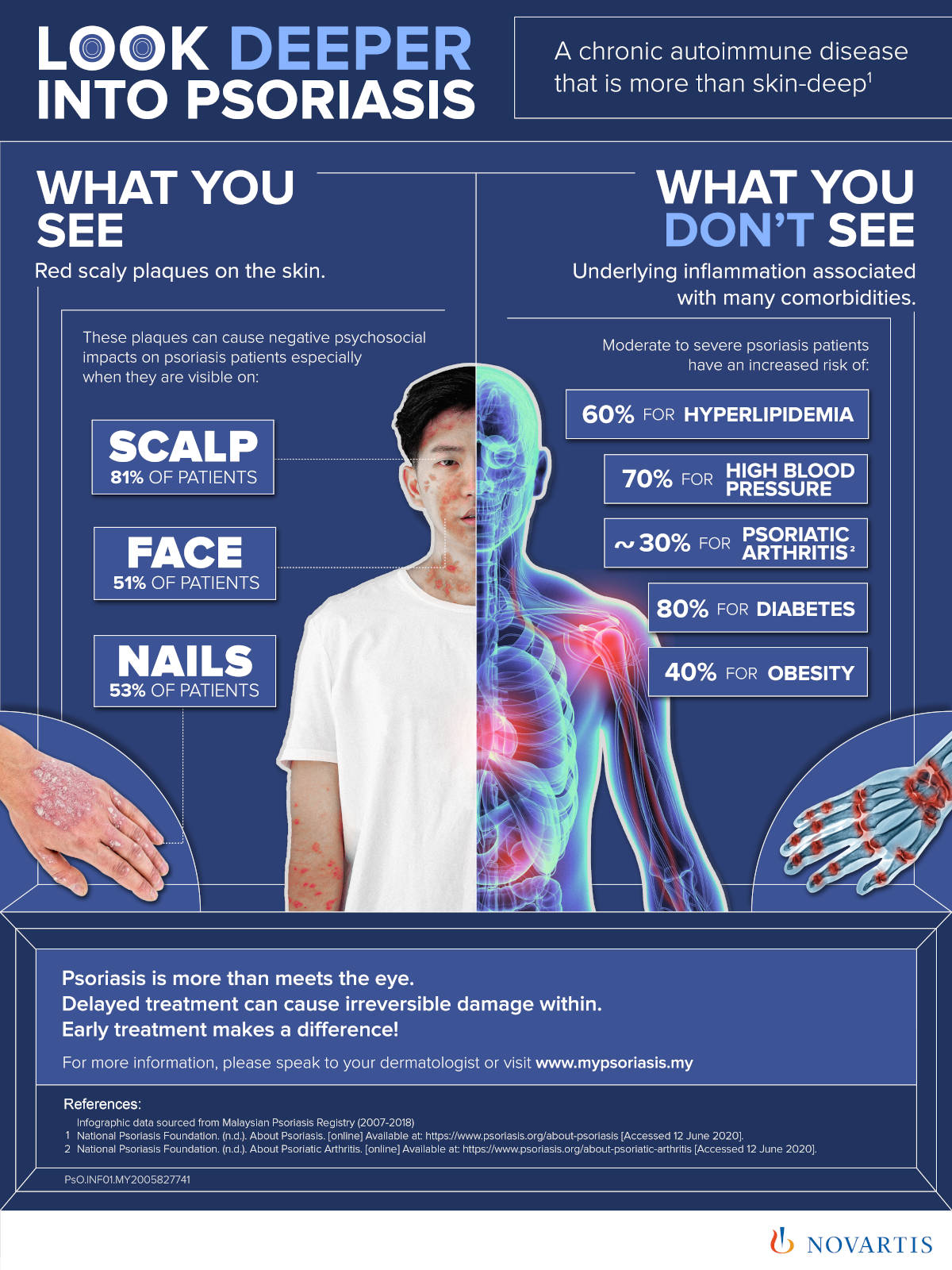 Look Deeper into Psoriasis MYPsoriasis